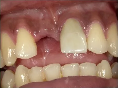 Cosmetic case 5 before treatment