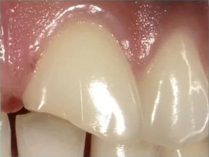 Cosmetic case 7 before treatment