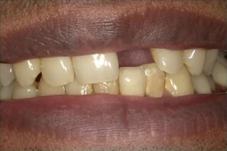 Cosmetic case 8 before treatment
