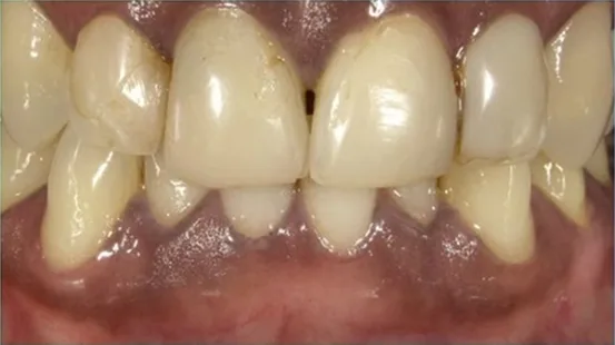 Cosmetic case 9 before treatment