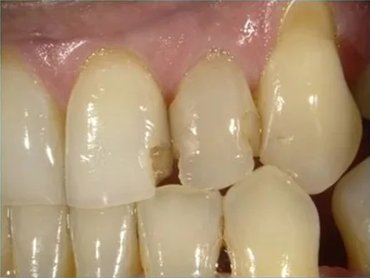 Cosmetic case 11 before treatment