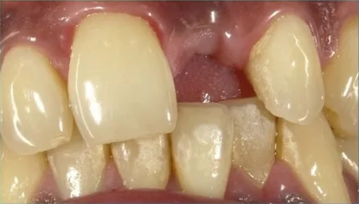Cosmetic case 12 before treatment