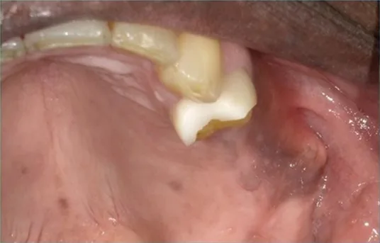 Cosmetic case 15 before treatment