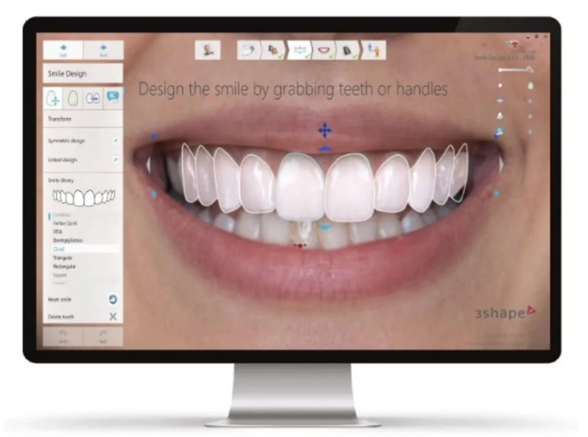 3Shape Digital Smile Design software showing a digital smile makeover preview
