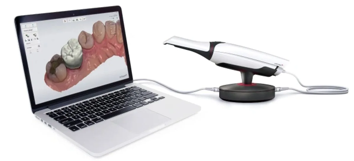 3Shape Trios intraoral scanner connected to a laptop showing a 3D digital dental impression