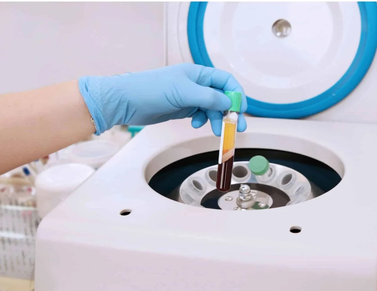 Platelet-Rich Fibrin (PRF)
