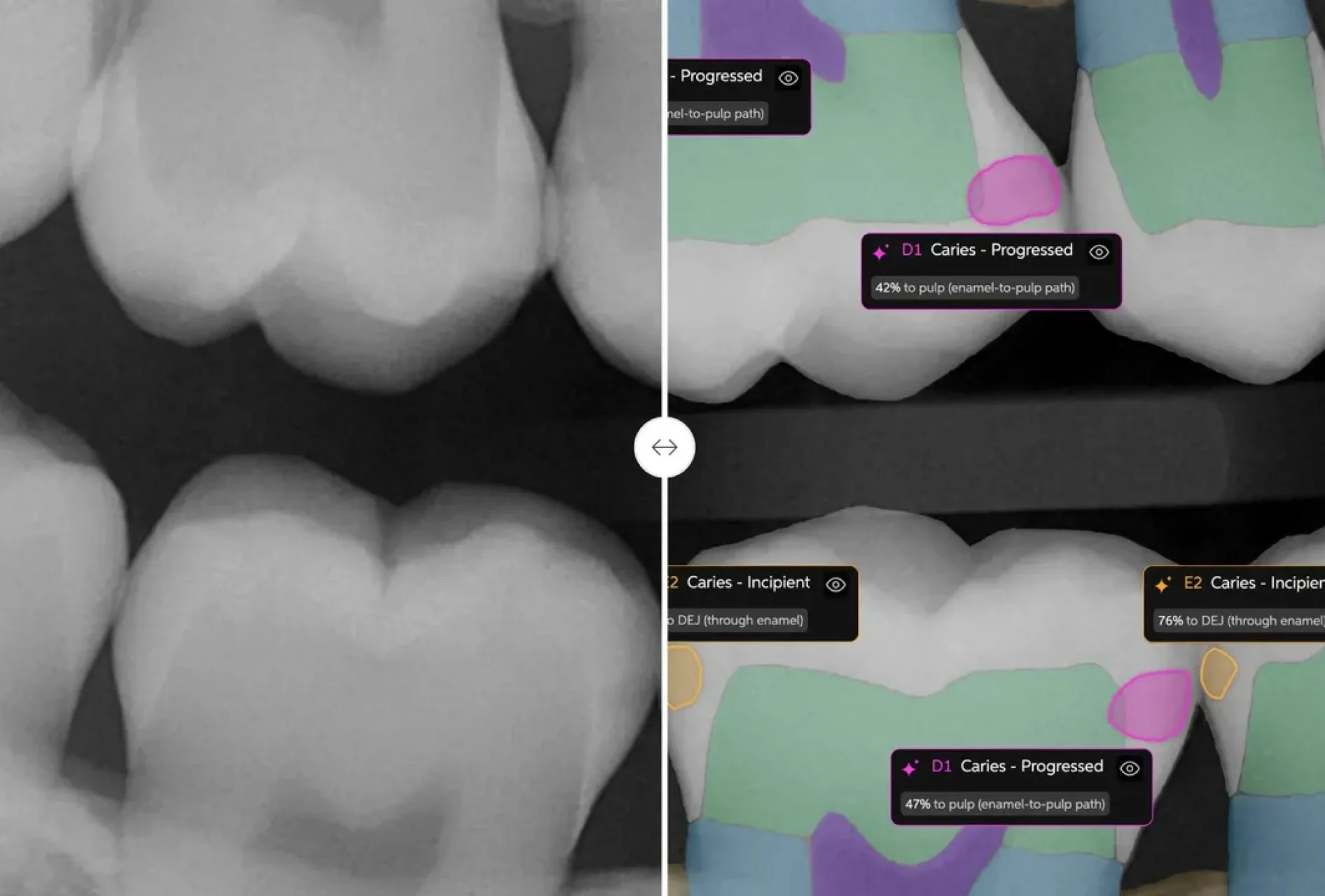 FDA-Approved AI Diagnostics