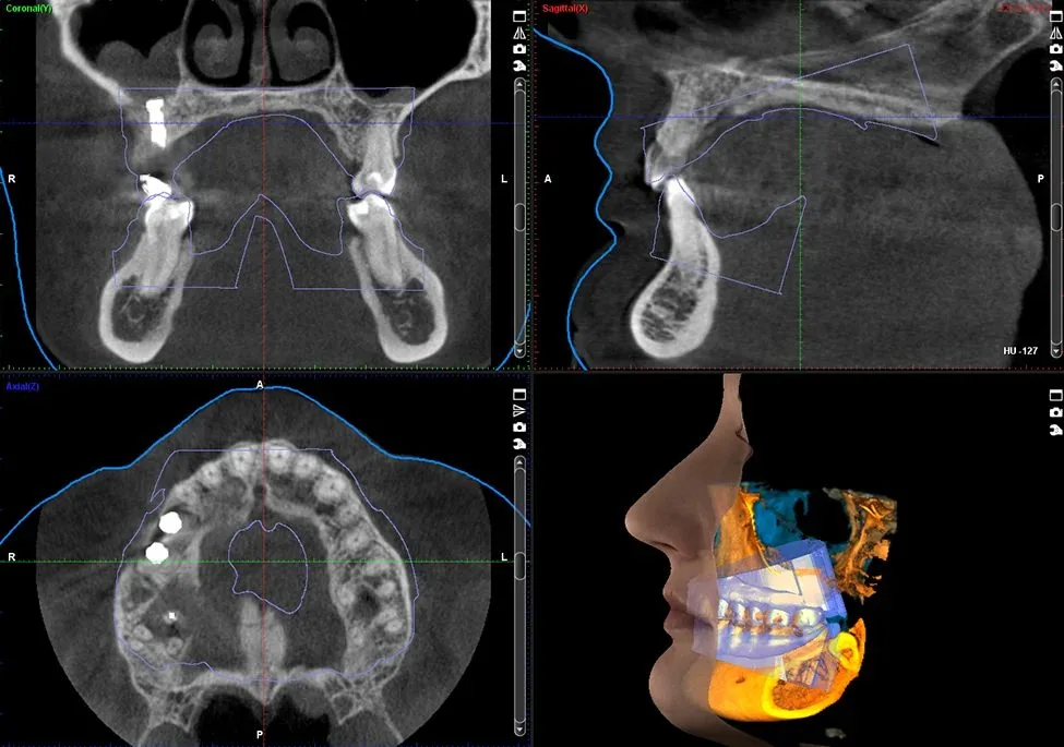 Planmeca Pro-Max® Cone Beam CT